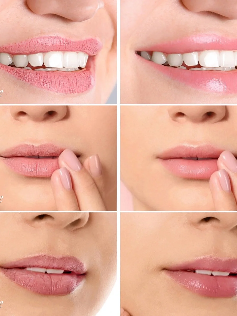 ArnCollect anrcollect lip